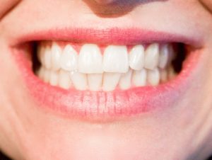 Lee más sobre el artículo La población en España elige al dentista por recomendación